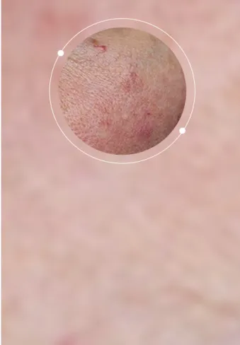 Combination Skin