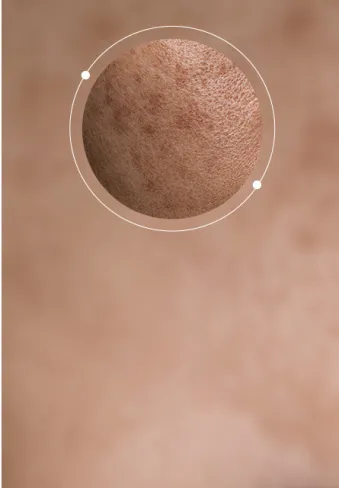 Dull / Discoloration