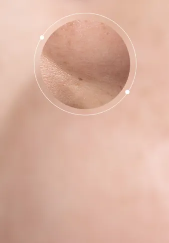 Normal Skin